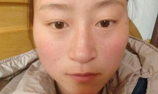 缩小鼻孔多少钱 缩小鼻孔多少钱